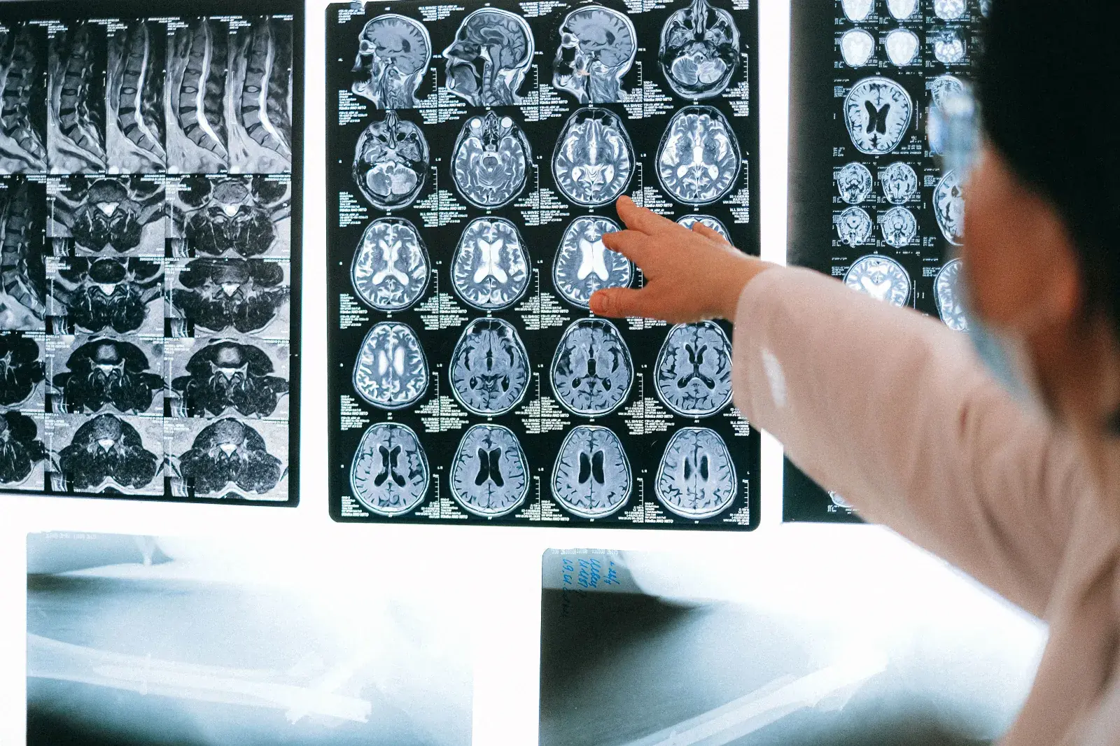 card image Radiology workflow automation dashboard for healthcare operations